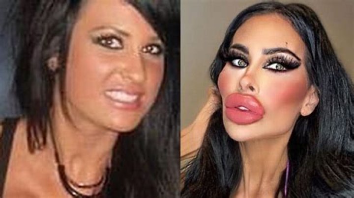 
Tara Jayne Mcconachy Before And After Surgey- Botched Star Sighted In Melbourne 