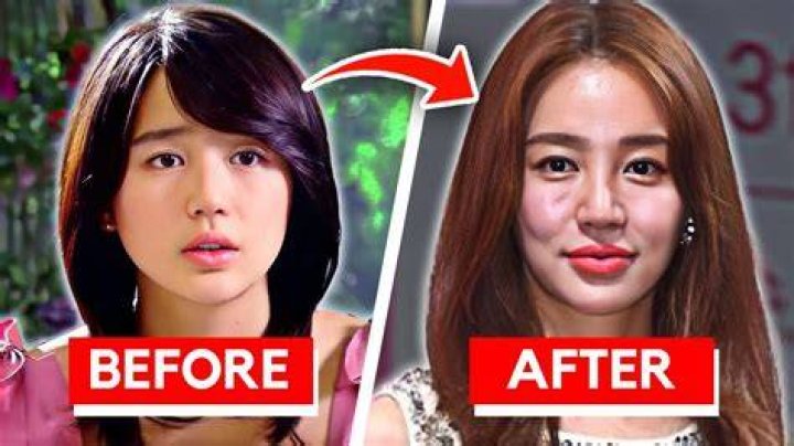 What Happened To Betsy Woodruff Face? Did She Undergo Jaw Surgery?