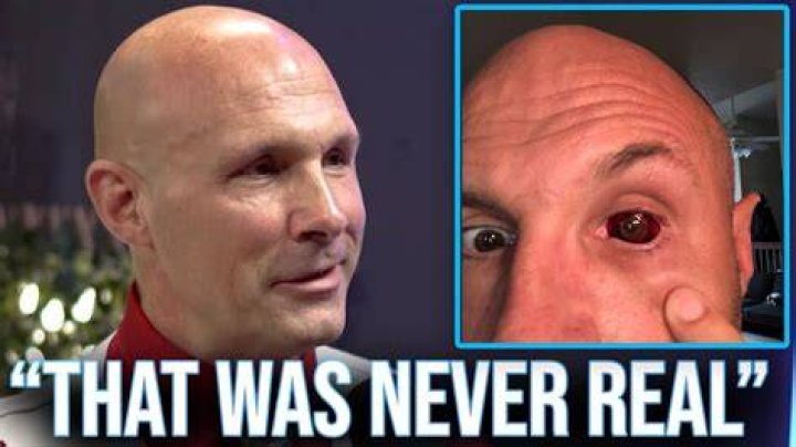 What Happened To Christopher Daniels Eye? Bloody And Bruised Mess From An Injury Explained