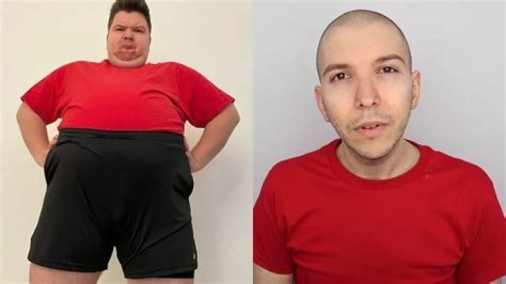 
What Happened To Nikocado Avocado? His Broken Ribs Issue 