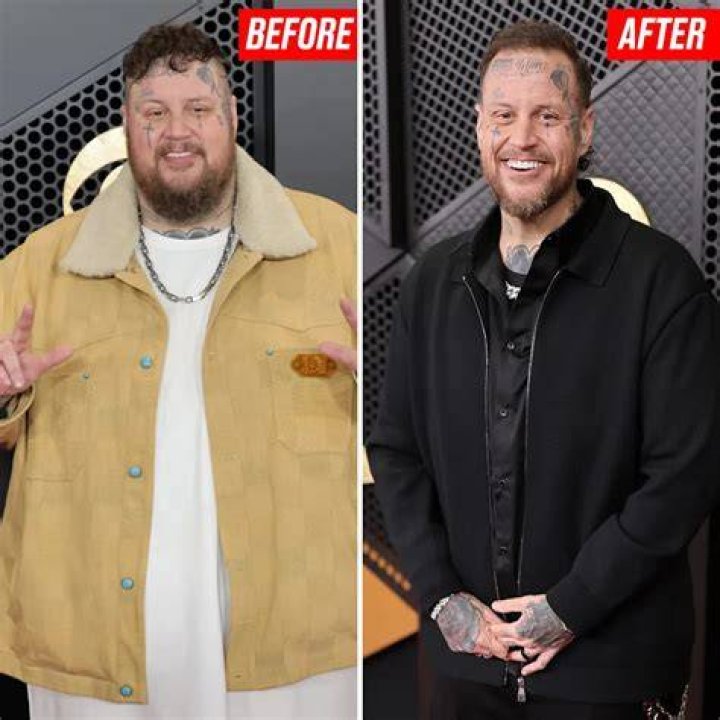 
What Heart Issues Does Rapper Jelly Roll Have? Health Update and Weight Loss Details 